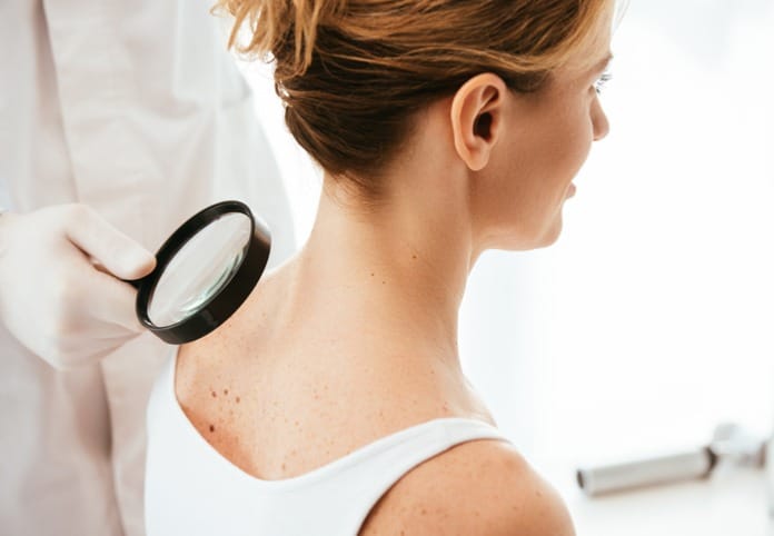 cropped view of dermatologist holding magnifying glass while examining woman with melanoma.jpg s1024x1024wisk20ckGefgb8 91aygG5aZV6gJdLdFizrH Ku9YqV6lMdgik